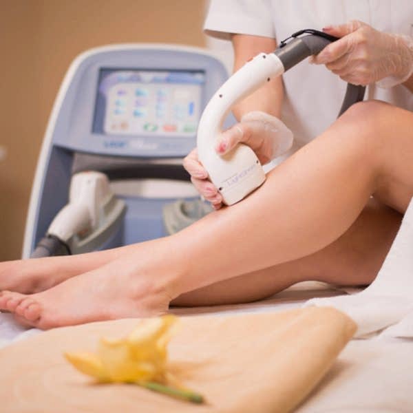 kayseri lazer epilasyon